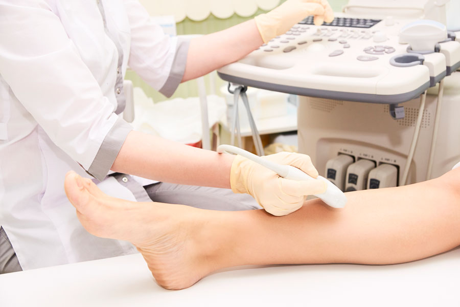 Sclerotherapy Vein Treatment